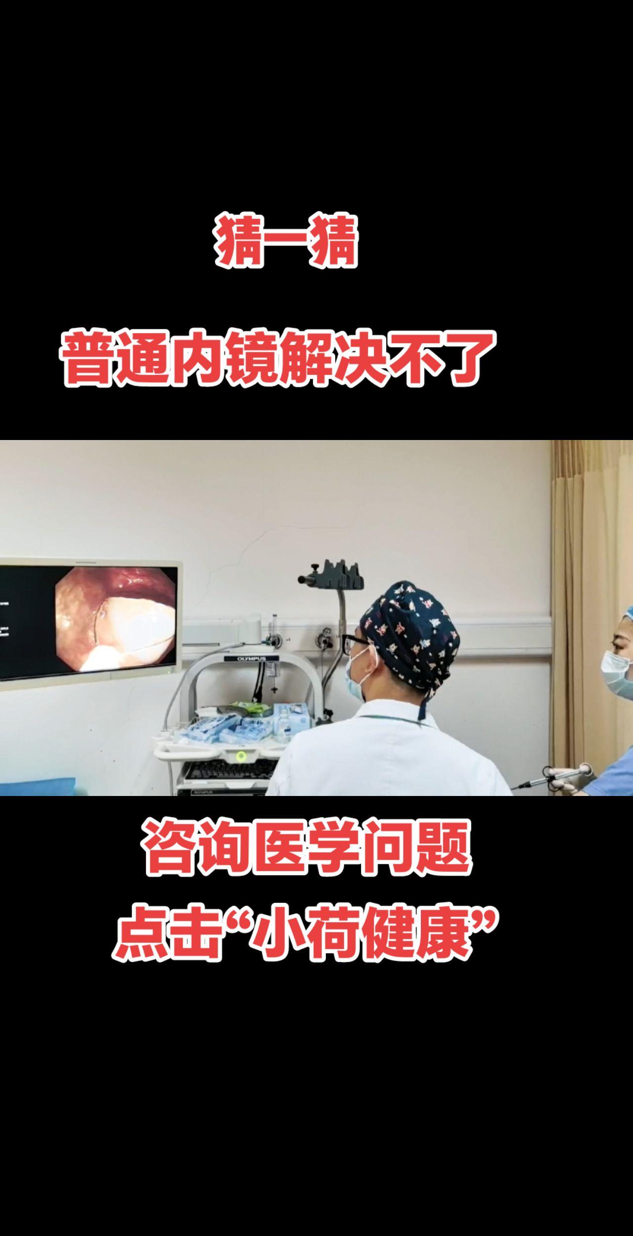 急诊内镜+手术，猜猜看这是啥。