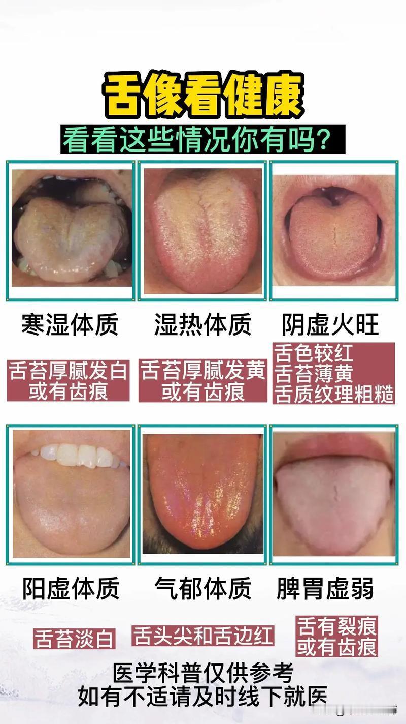 看舌象知健康，看看这些情况你有吗？#健康##舌象分析#