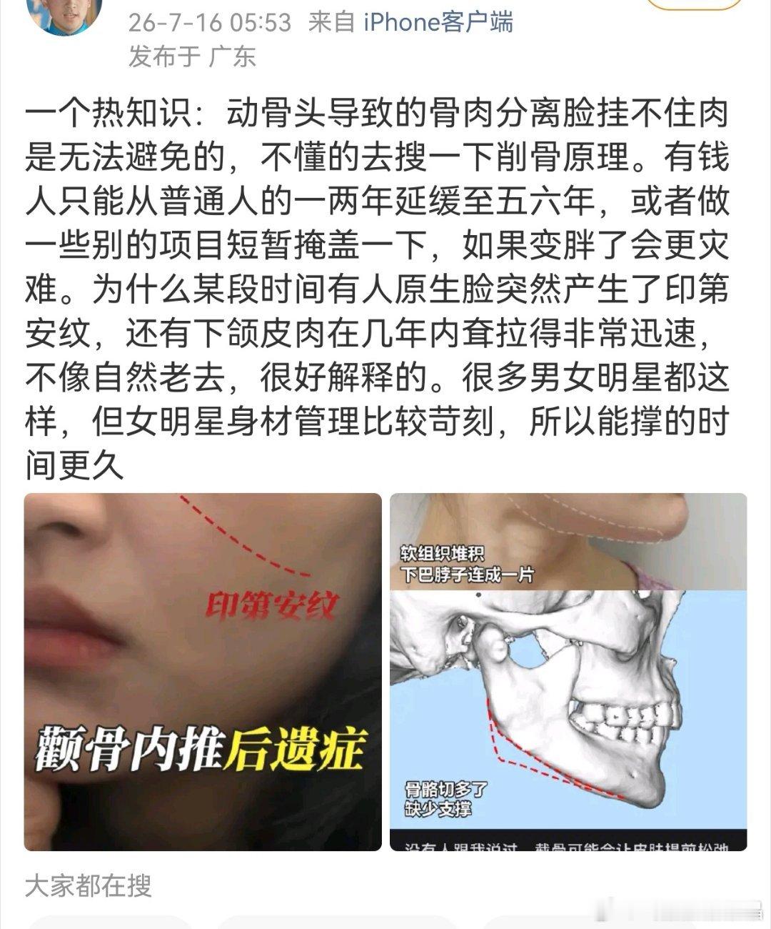 脱粉ie从科学角度解释咯咯脸上的纹路 