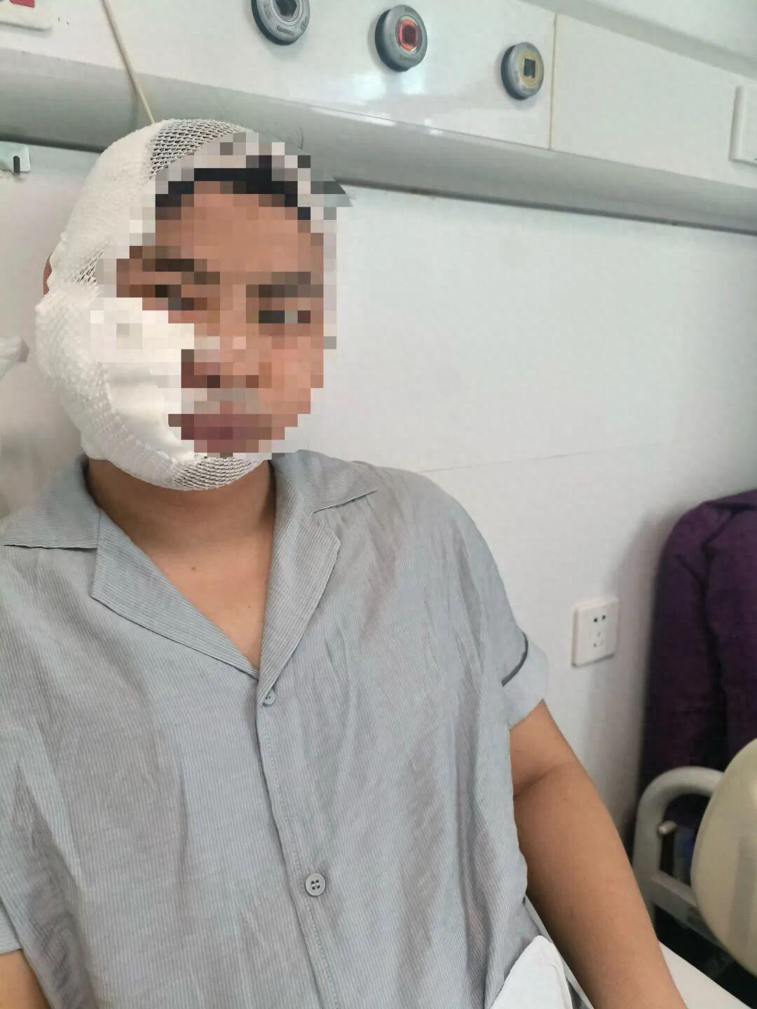 长沙一男子在海洋王国被3米长的鲨鱼咬伤头和脸，景区工作人员之前还跟他说，这个项目