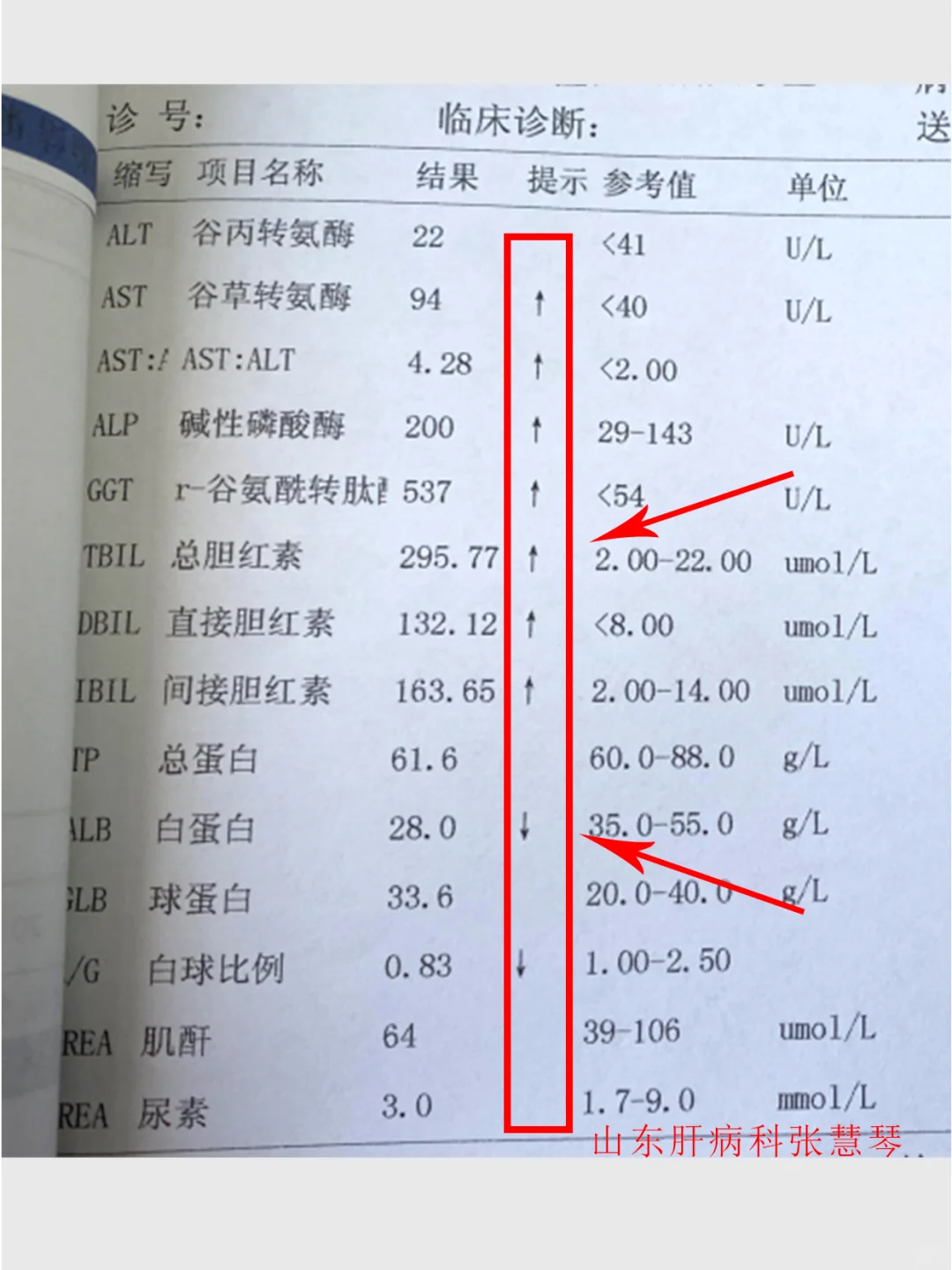 又一例肝硬化！本来可以控制却拖到如此严重