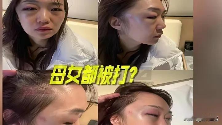 又是一起家暴事件
每次看到我都会发抖
为啥就没有人可以出个文件，彻底杜绝呢

