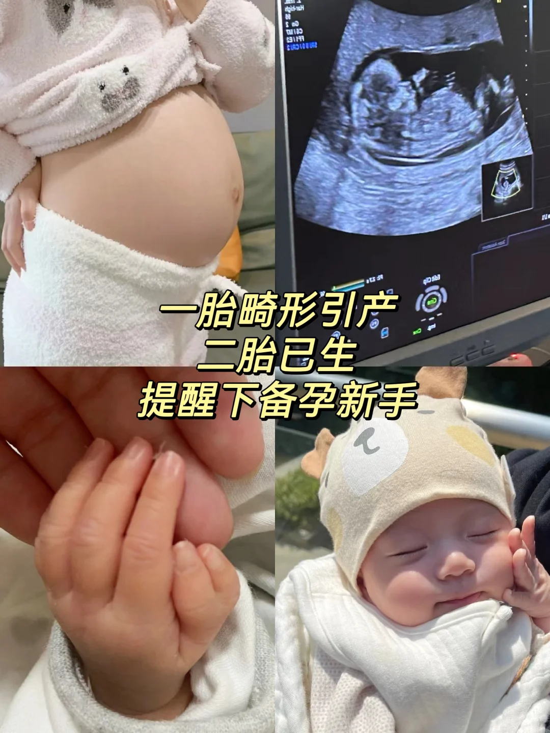 胎儿畸形引产，提醒下吃备孕叶酸姐妹