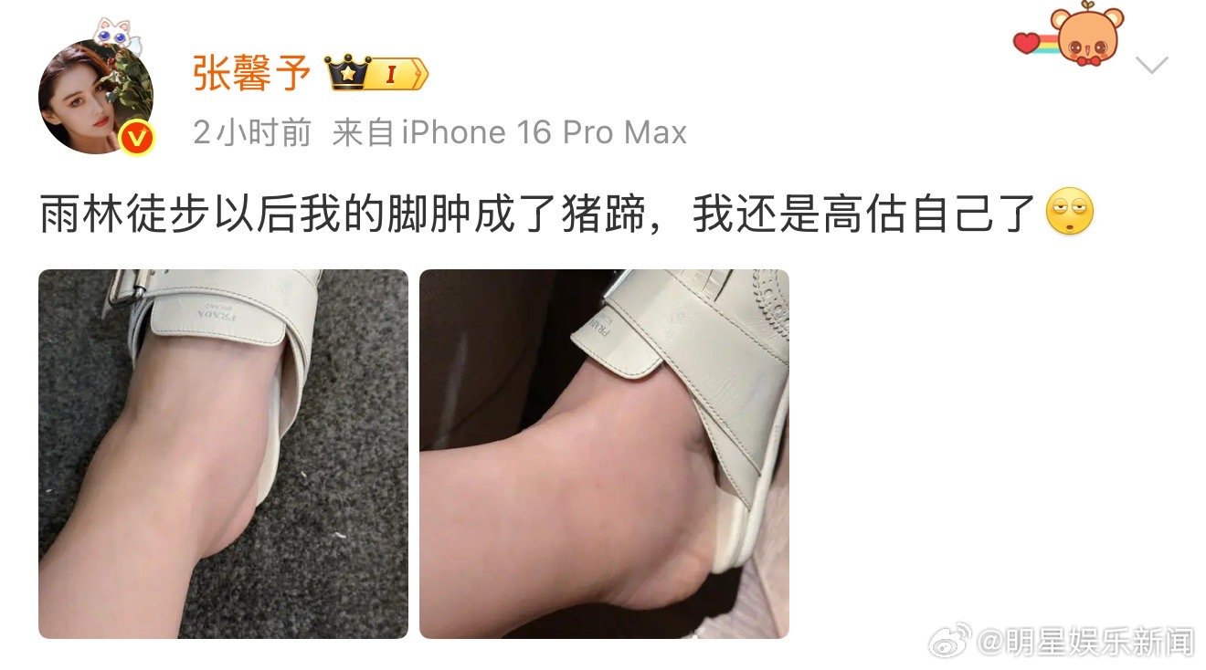 张馨予雨林徒步脚肿成猪蹄 张馨予在西双版纳每天暴走的结果就是脚肿成猪蹄吗[允悲]