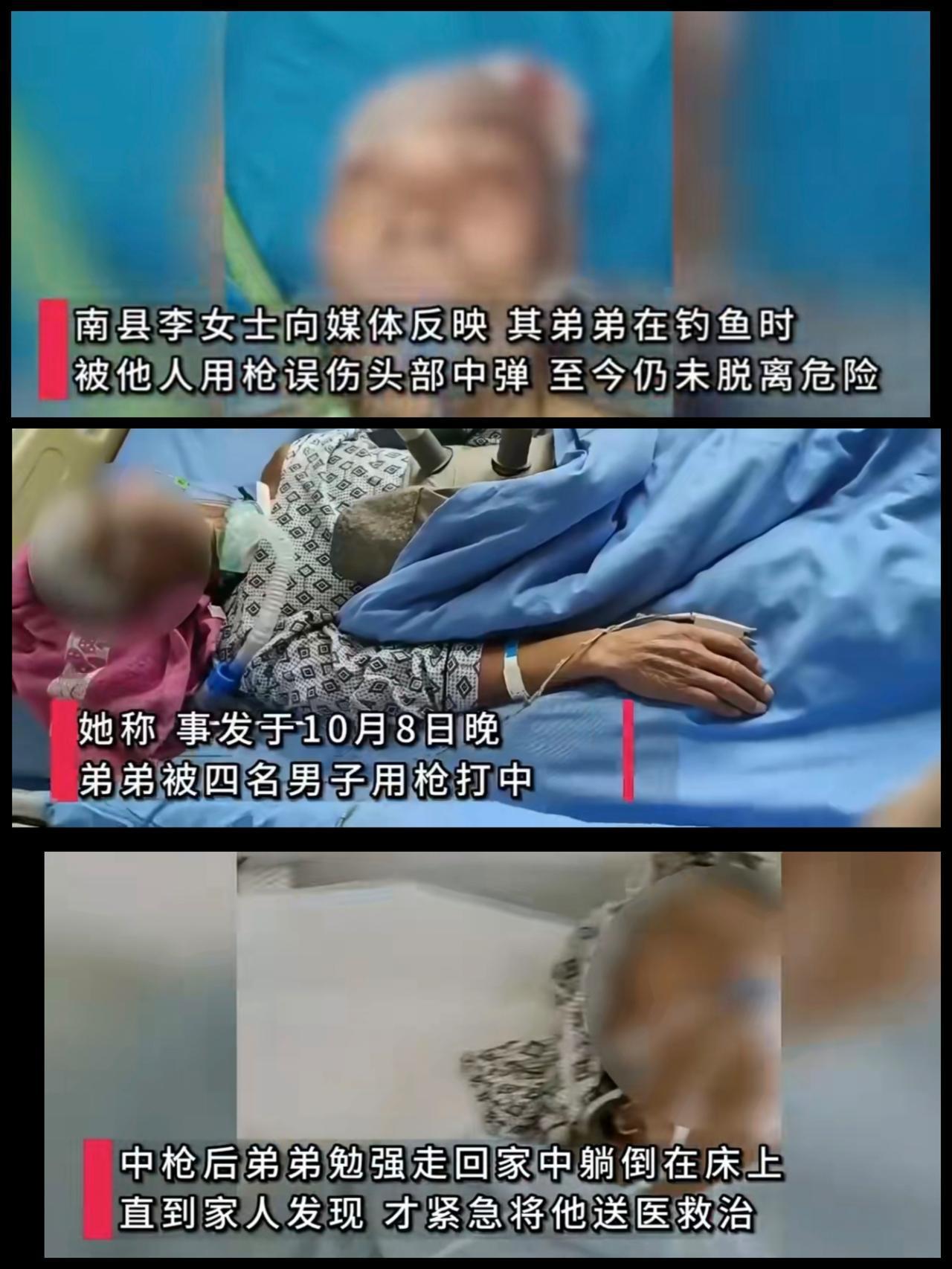 真吓人，湖南益阳一大爷喜欢夜钓。在今年的十月份的一次夜钓中，被人用枪打到头部，导