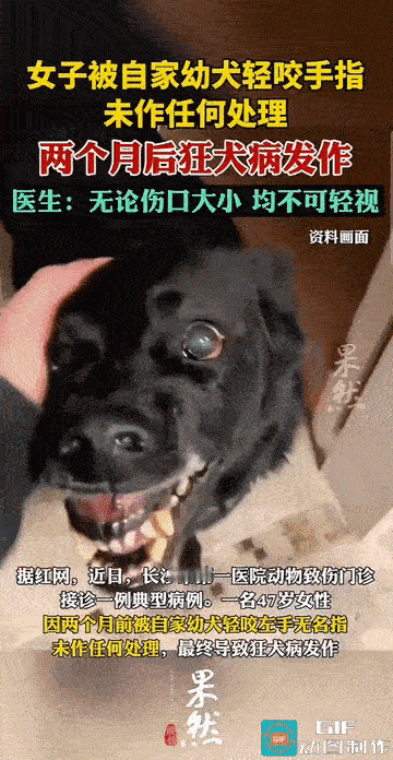 “太大意了！”湖南长沙，一名47岁的女子被自家幼犬轻咬左手无名指后，仅感到轻微疼