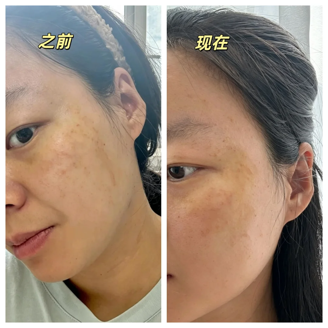 续更|孚立美15天