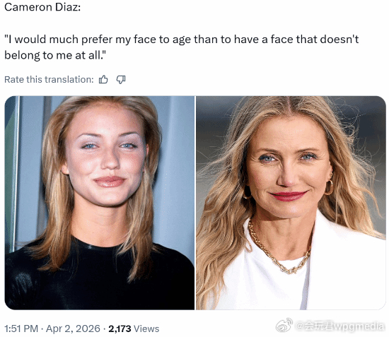 卡梅隆·迪亚兹拒绝医美：我宁愿变老 也不愿拥有一张完全不属于我的脸卡梅隆·迪亚兹