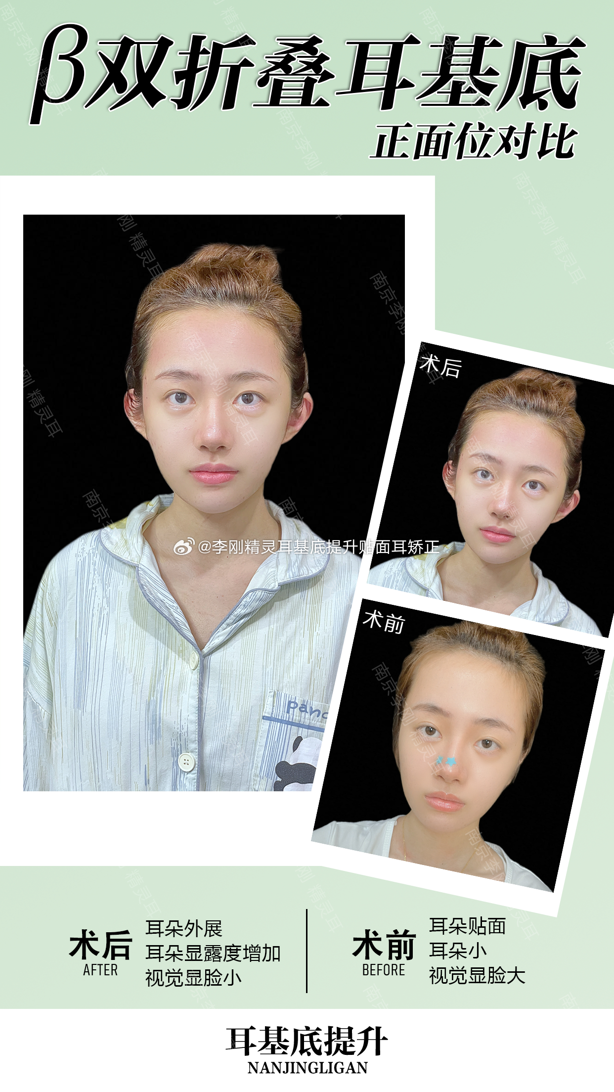 小耳朵正面看不到怎么办？马思纯把球衣穿成了夏日高定