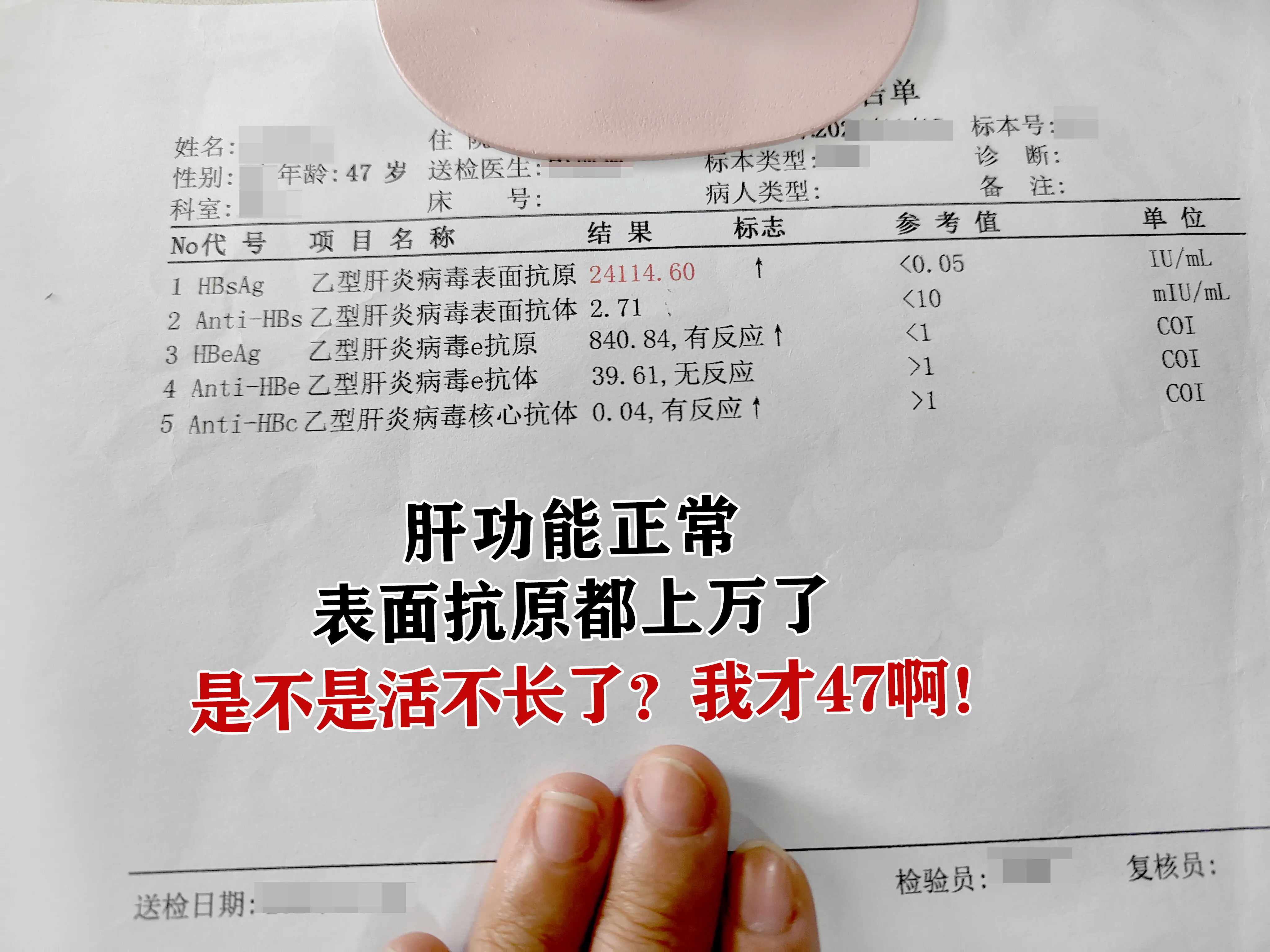 你这个是个大三阳，大三阳一般病毒复制活跃，传染性强，表面抗原相对来说比...