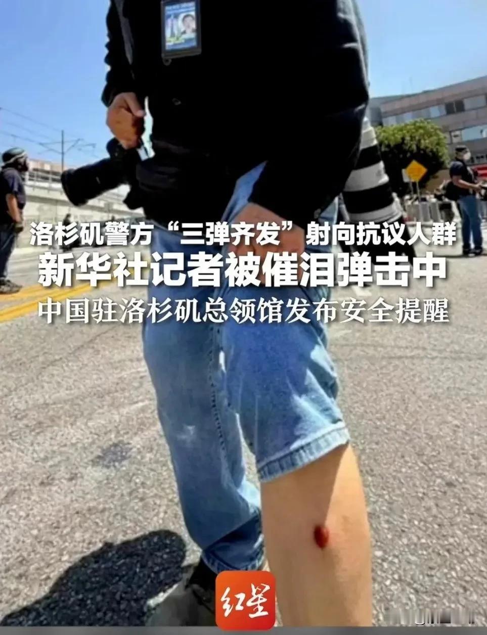 洛杉矶暴乱再次升级，新华社记者在现场被警方橡皮子弹击中！特朗普声称:将解放洛杉矶
