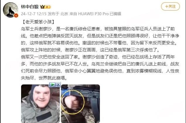 乌克兰战场上有一个叫谢廖沙的特殊士兵，他是一个唐氏综合征患者，可他却阴差阳错被送