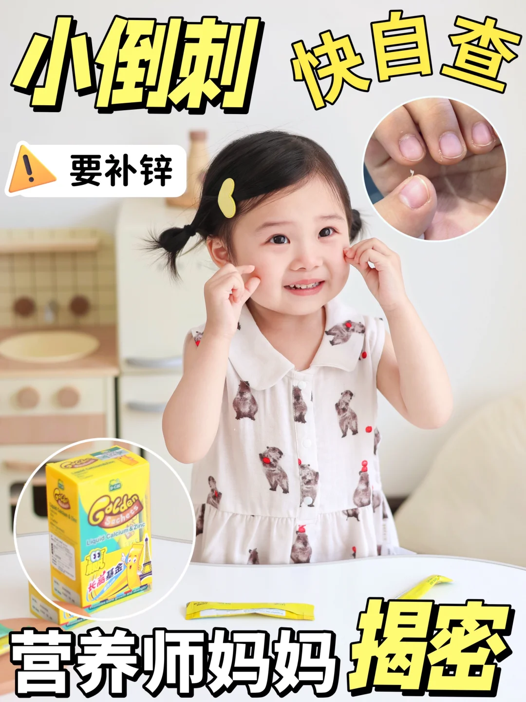 快自查❗看看宝宝手上是否长出小倒刺
