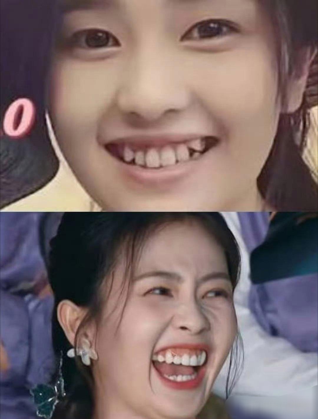 大笑露真容，同是原生乱牙，白鹿和杨紫这俩谁更狠厉些？ 