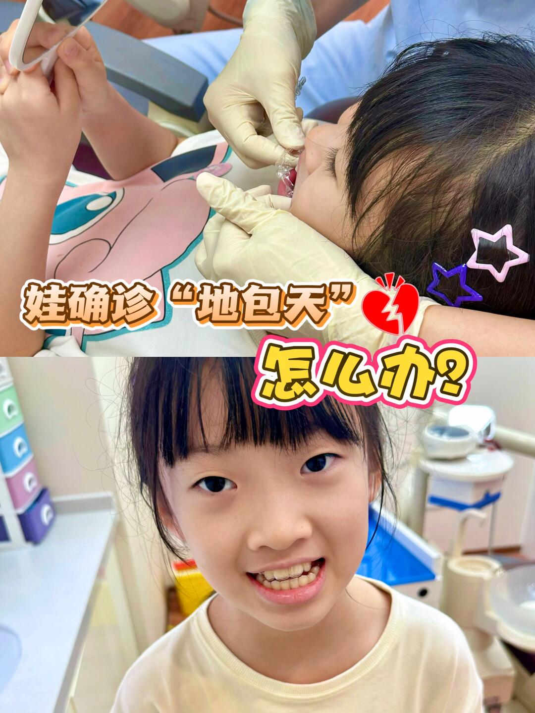 娃确诊“地包天”，老母亲心碎后火速自救！