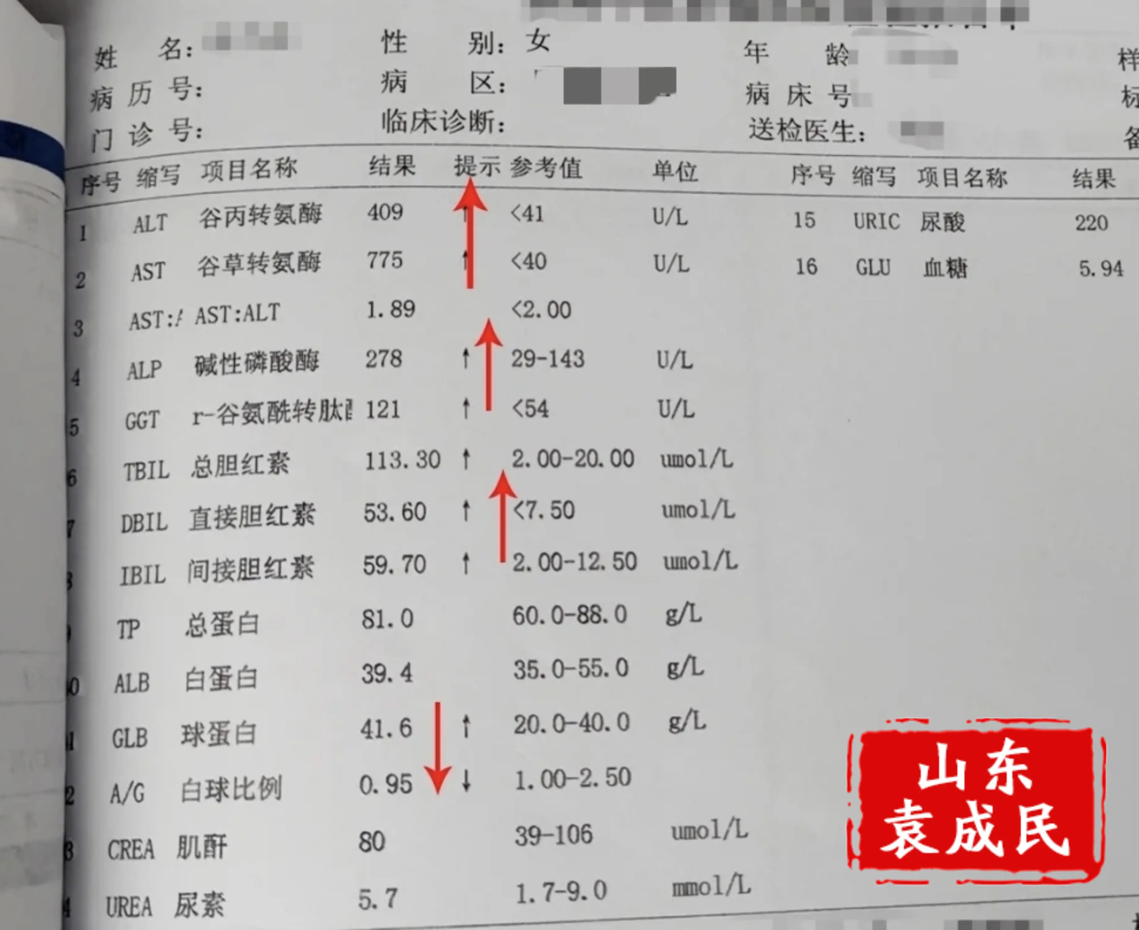 医生最怕：肝病检查报告上出现这7种提示! ①甲胎蛋白升高大于400，往...