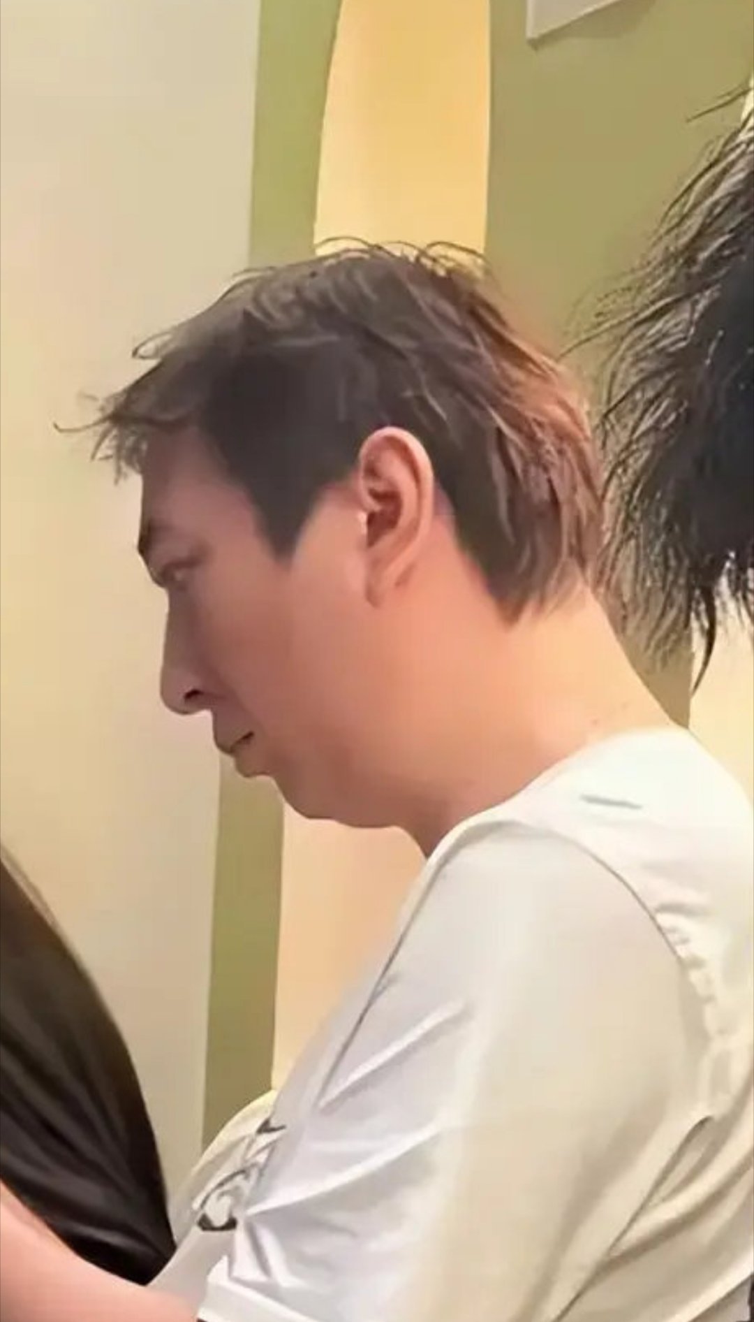 下巴后缩严重，代表行动力强，冲动型人格。多数时候说话做事没有经过深思熟虑，决策失
