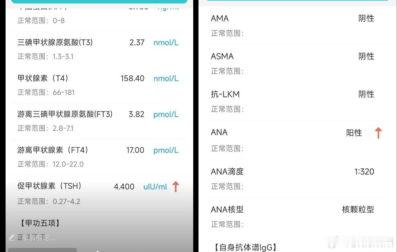 #乙肝[超话]#干扰素副作用包括自身免疫抗体异常，甲功异常。但目前干扰素副作用这