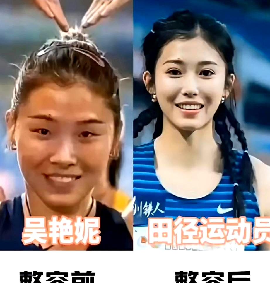 冠军整容前后对比，哪一个更自然？
 

内容涉及吴艳妮、杜丽等中国运动员的整容前