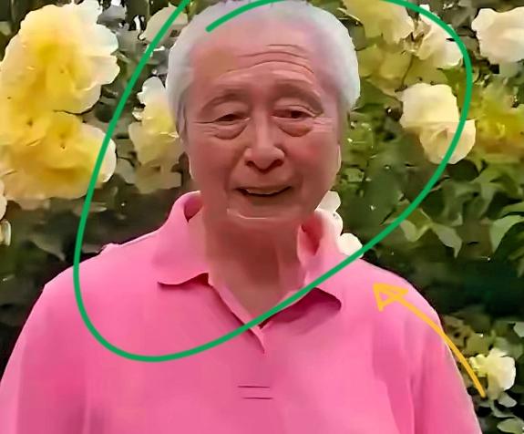 87岁名嘴宋世雄近况曝光，独自一人住在北京工体附近的养老院，儿女都在国外，身边连