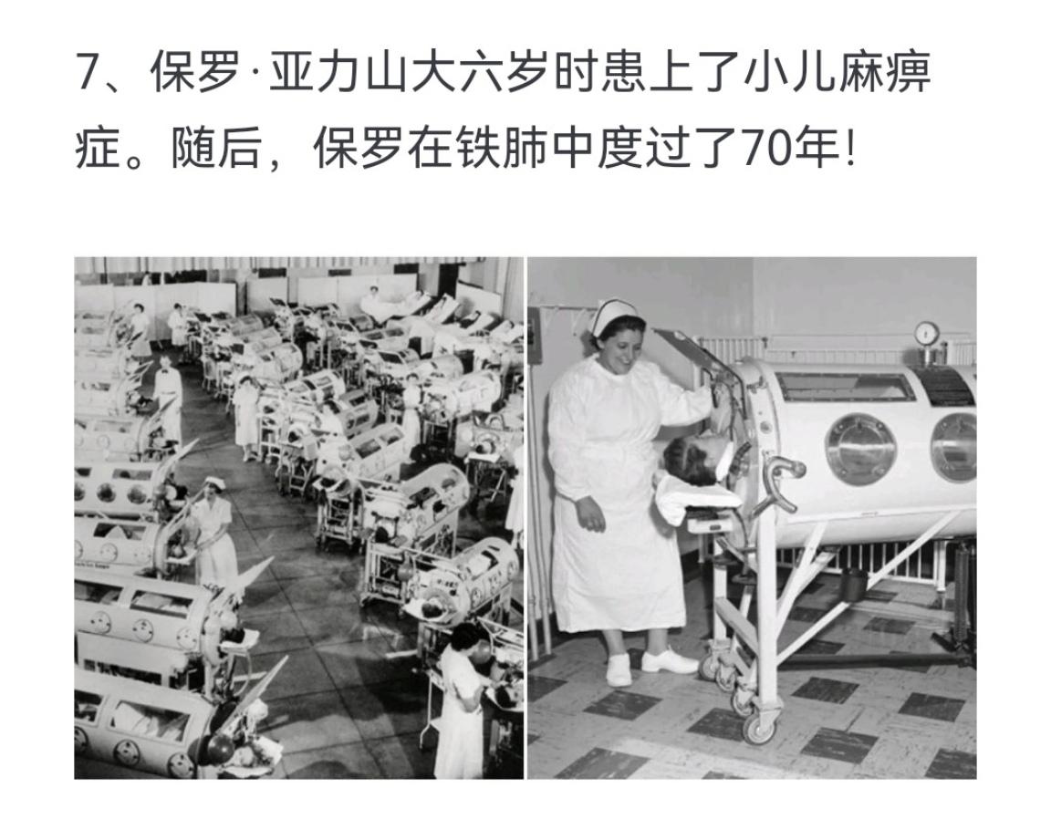保罗．亚力山大六岁时患上了小儿麻痹症。随后，保罗在铁肺中度过了70年