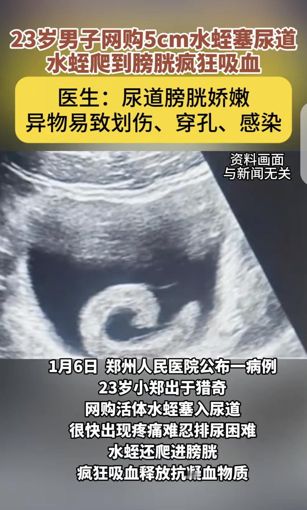 “好奇害死猫！”河南郑州，一23岁小伙听信某偏方，他出于好奇，竟然真网购一条5c