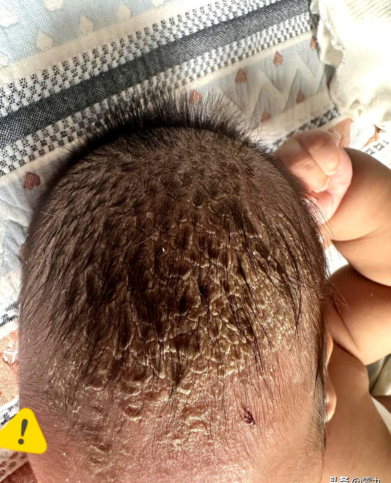 水柱一冲，手就痒了，偏那一小块不让动，越看越想扣。
洗澡都不敢用力，像端着一盏烛