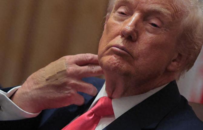 特朗普手背上的“青一块紫一块”的原因终于不用再瞎猜了，从2025年跟马克龙见面被