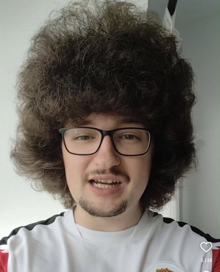 可能头发还要再等等老哥诺丁汉森林2比2曼联 ​​​