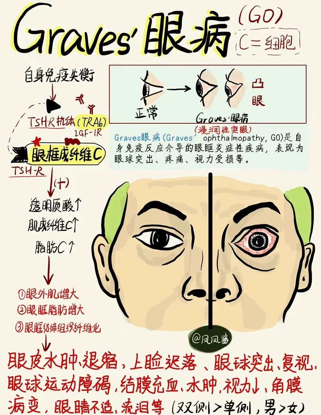 手绘笔记📝graves 眼病 建议点赞收藏