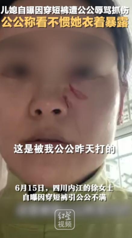 2023年四川，女子觉得天太热，就在家穿清凉小短裤。岂料与公婆吃饭时，公公盯着看