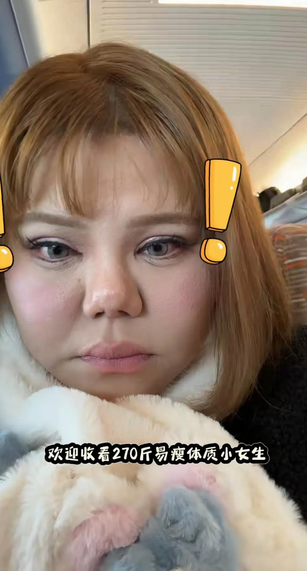 这眼睛看起来好美，鼻子也是歪的，[有些人不整还算自然干净的好看，整了比没整难看。