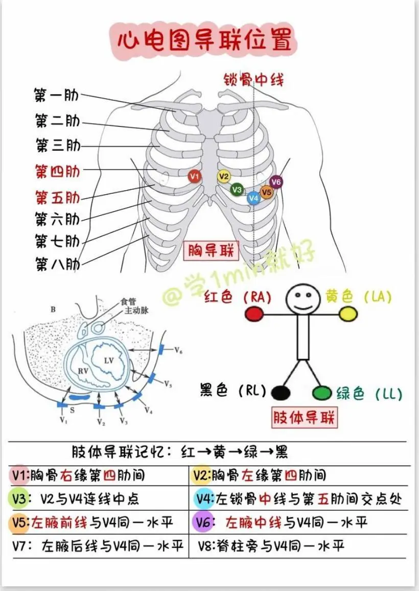 心电图位置。你们医院是护士还是医生做心电图？