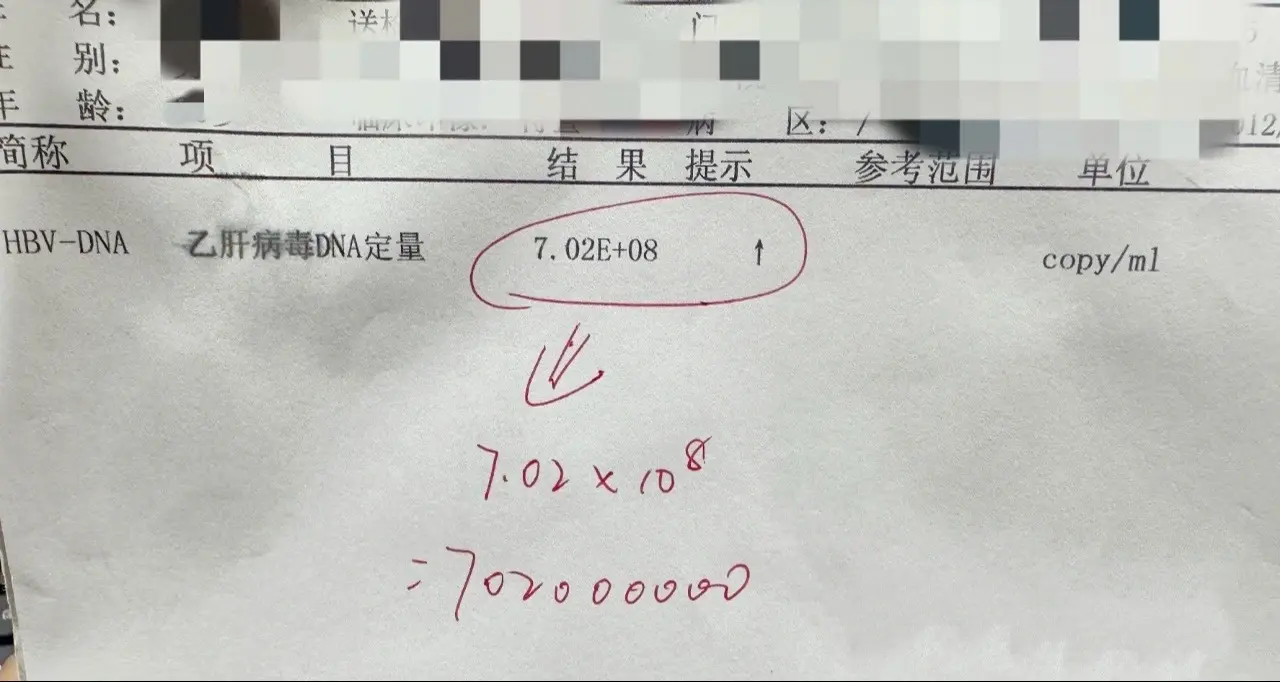 今天接诊了一个山东的乙肝患者，病毒量10的8次方，患者自述服用恩替卡韦...