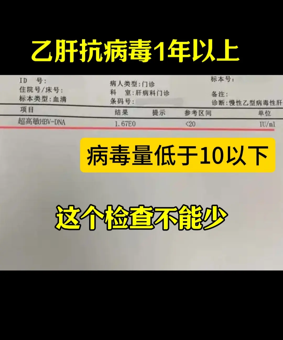 有乙肝不用怕，做对检查选对方案很关键！ 大家好，我是山东陈士俊教授，大...