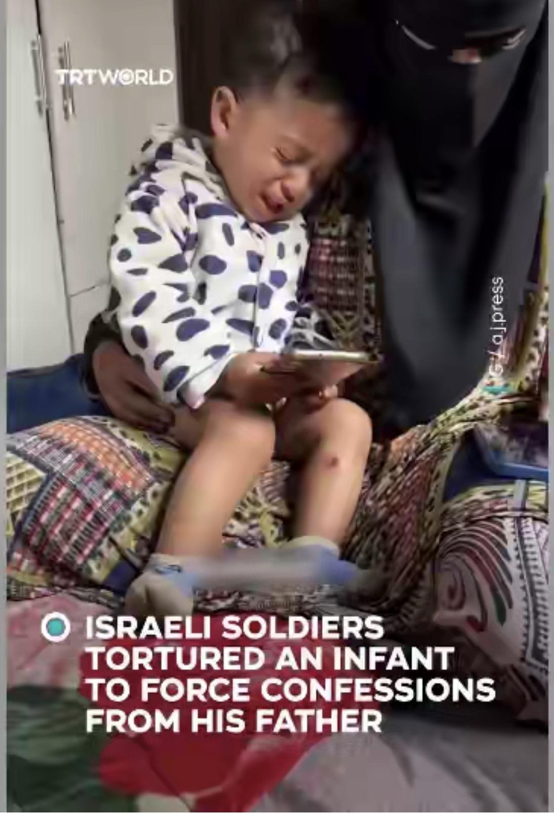 哎我去！以色列你们还是人不是？对18个月，也就是一岁小孩用酷刑，用钉子扎，用烟头