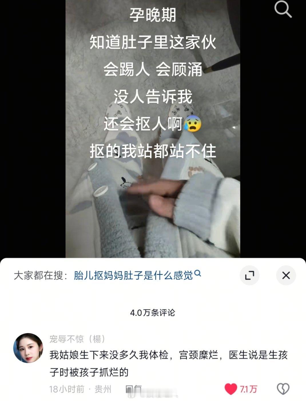 每次刷到这种生育分享都会忍不住感叹，这些妈妈真的太伟大了[泪]我光看文字抖头皮发