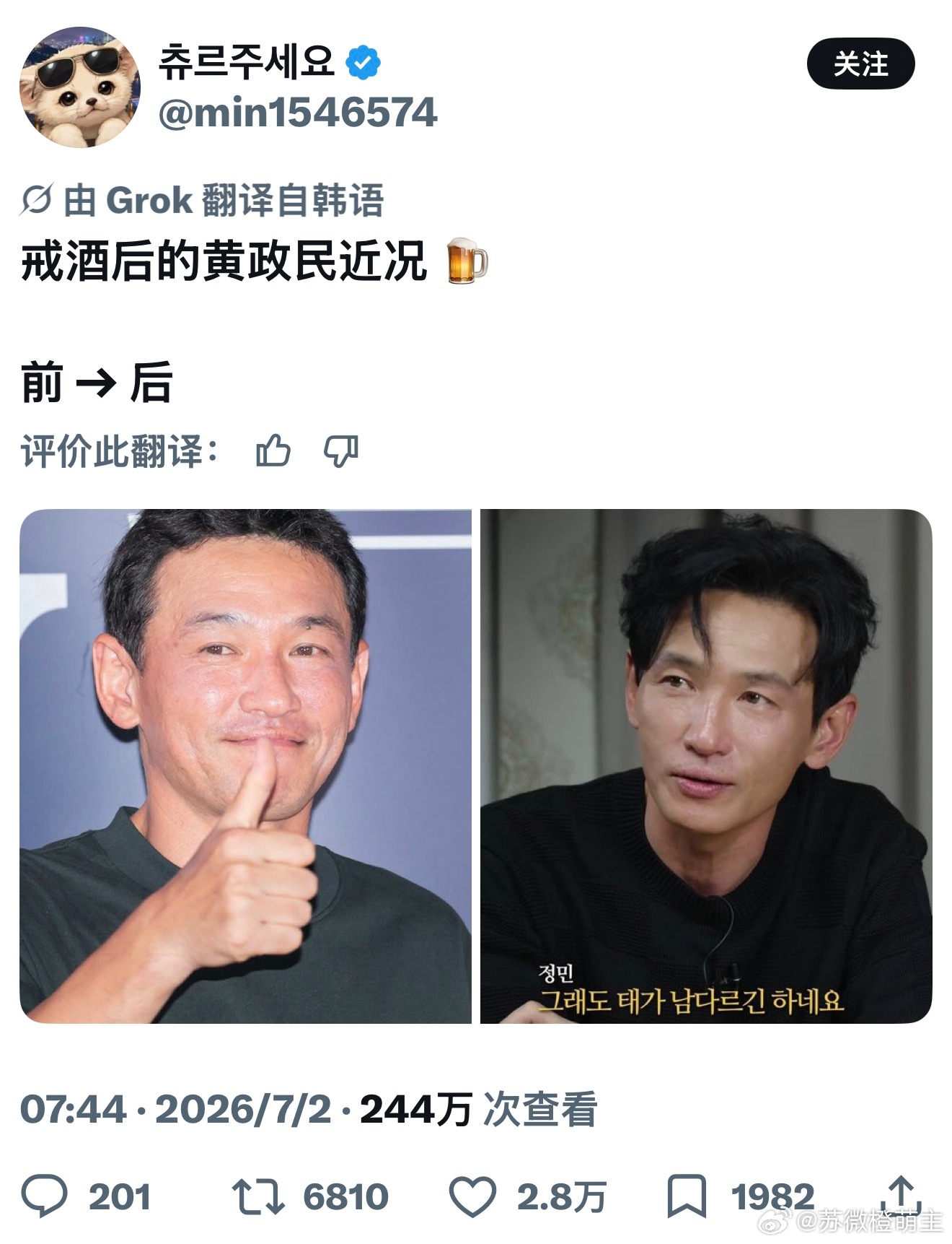 【热推2.8w赞】戒酒之后的黄政民近况～自律才是最好的医美 