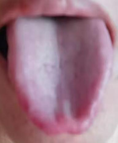 专注男性健康，守护男性身心状态






古代人出现了宗筋不振不能行事的问题是