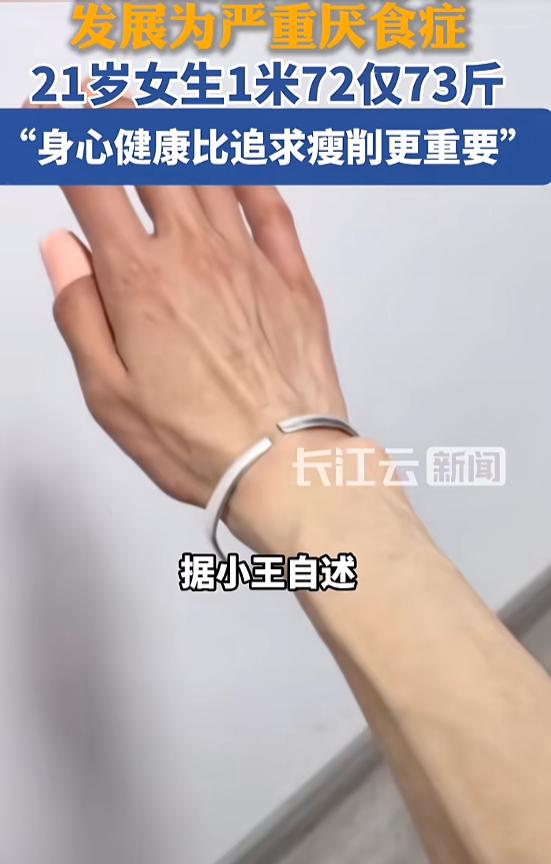 “难以置信！”9月4日报道，安徽，一女子身高1.72米，可体重只有73斤，她长期