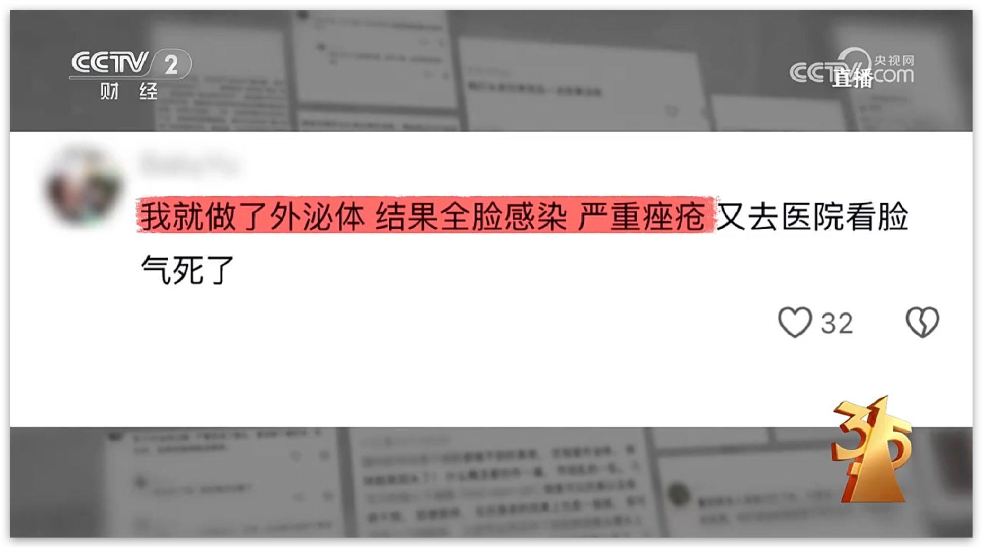 315晚会今晚的第二个雷：外泌体抗衰医美。这个应该对不少女孩子影响挺大吧？大家有