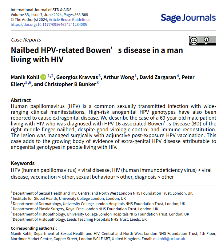 美甲工具混用有人感染HPV这绝对有可能，国内外都有报道。消毒不彻底可能感染HPV