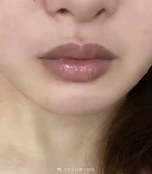 【贴士】 嘴唇发紫不一定是心脏问题。皮肤薄、血管丰富的唇色本就个体差异大，天然唇