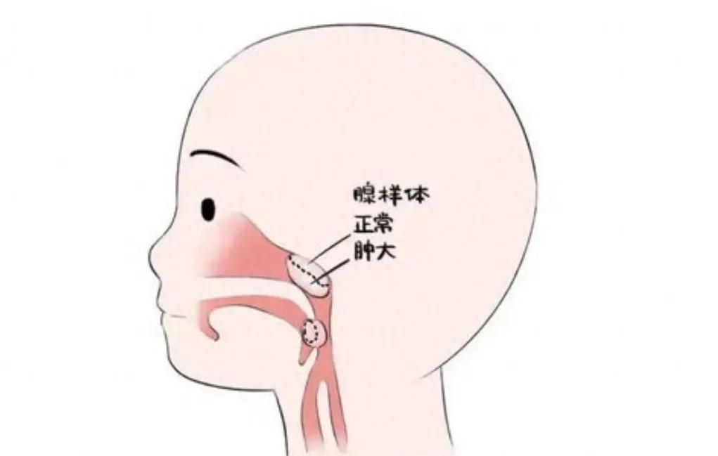 孩子腺样体肥大：入秋后把冷饮换成它，每天一碗，排尽全身湿热废水，呼吸顺畅了
入秋