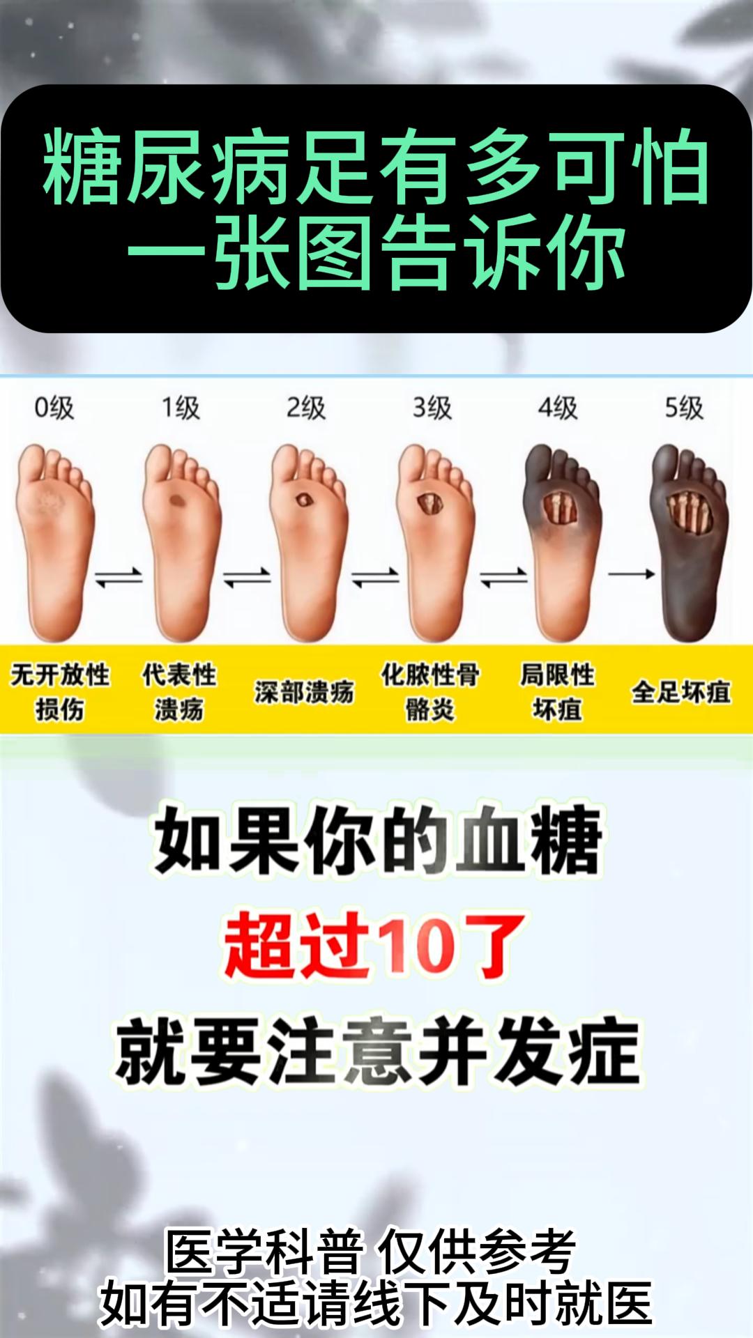 糖尿病足有多可怕 一张图告诉你#养生##中医##健康#