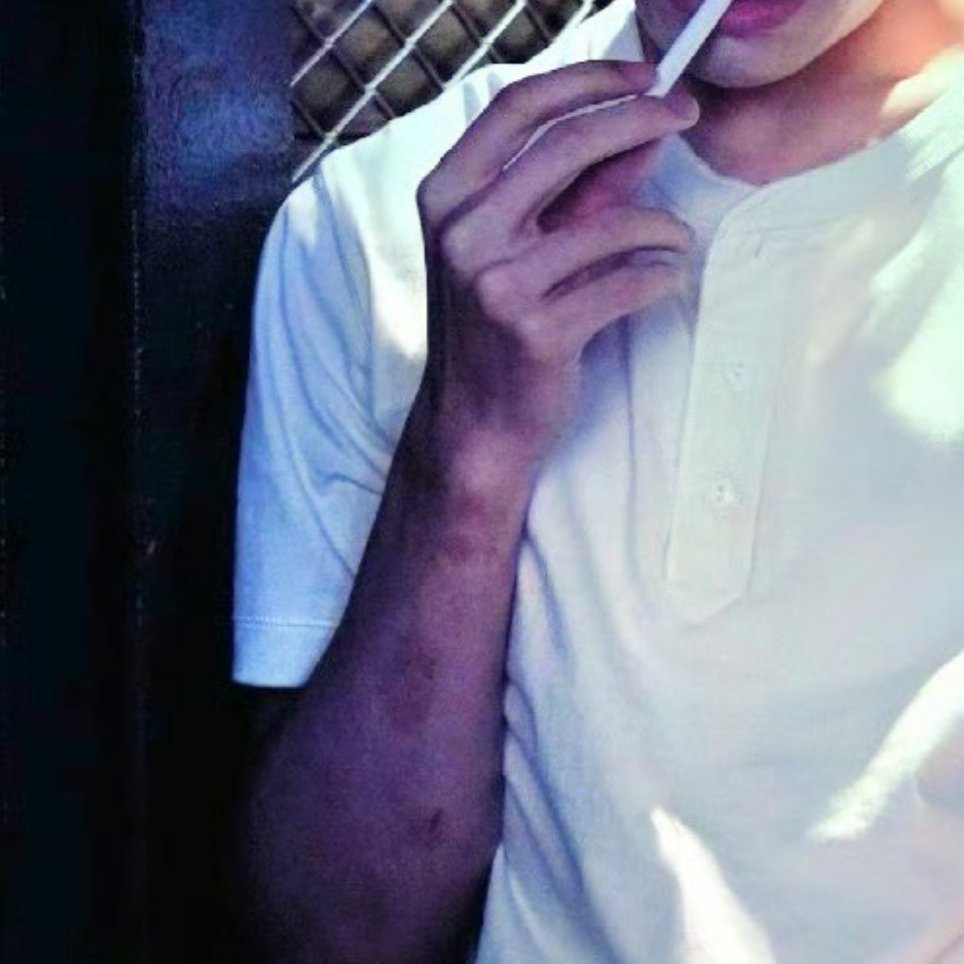 邱儿手上的伤痕就是那个疯子长官欺负我妈咪 