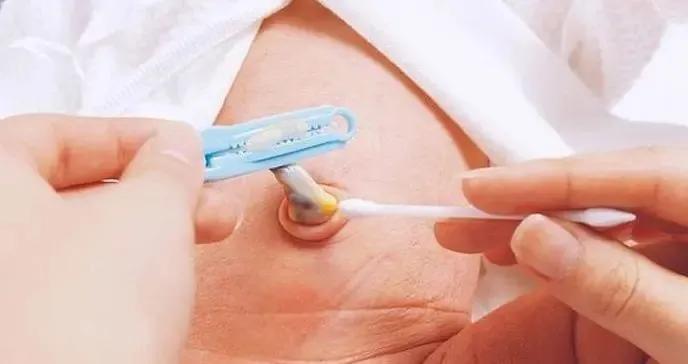 孩子的肚脐能抠吗？#新手爸妈指南##儿童健康守护者计划# 

婴幼儿的皮肤娇嫩，