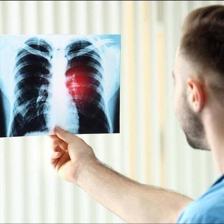 医学调研643名吸烟者，惊奇发现：易得肺癌的人，有这6个共性！

吸烟和肺癌的关