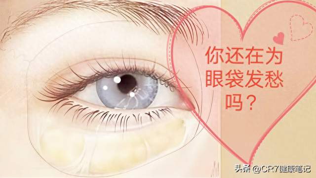 同样是眼袋，凭什么她的涂眼霜就好，你的却得动刀？