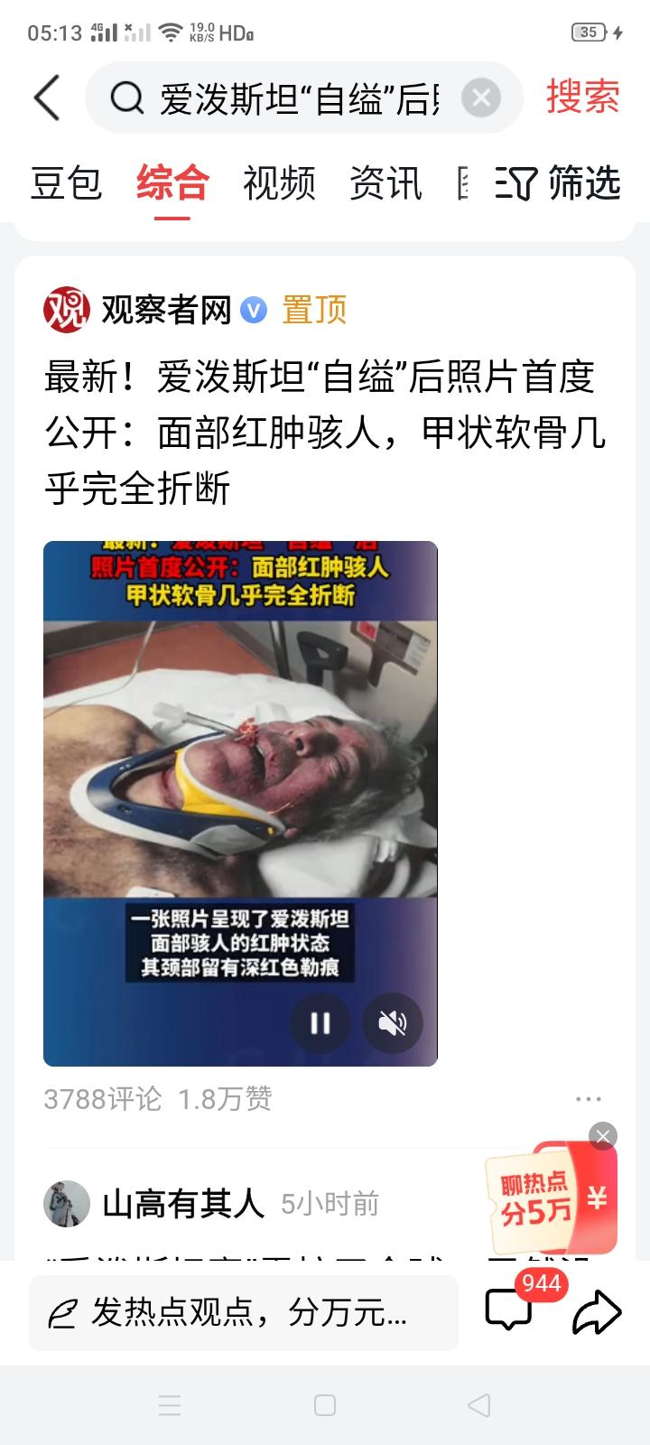 “罗莉岛”事件以爱泼斯坦的“自溢”而剧终，而参与“性侵”、“吃娃娃菜”的一众大佬